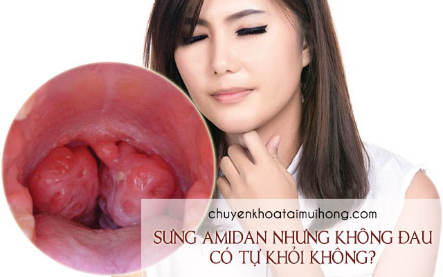 Sưng amidan nhưng không đau có tự khỏi không?