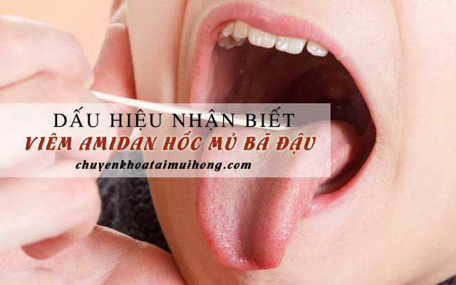 Dấu hiệu bệnh viêm amidan hốc mủ bã đậu