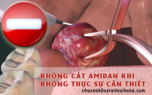 Không cắt amidan khi không thực sự cần thiết