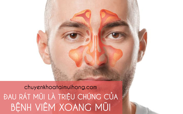 Đau rát mũi là triệu chứng của bệnh viêm xoang mũi