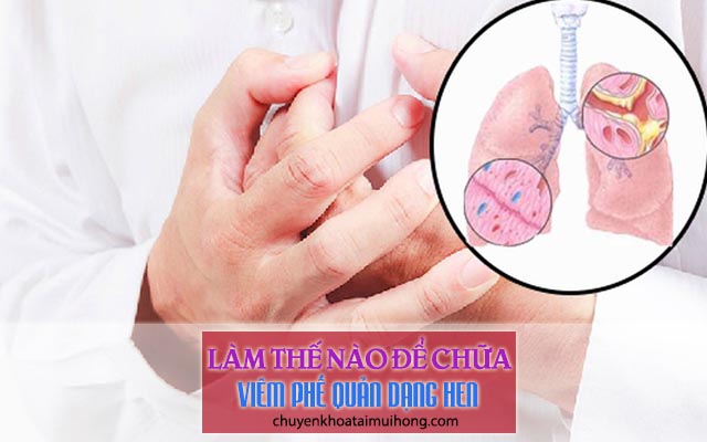 Làm thế nào để chữa viêm phế quản dạng hen