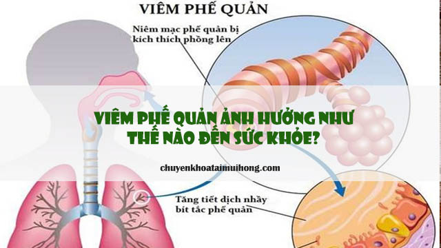 Viêm phế quản gây ảnh hưởng như thế nào đến sức khỏe?