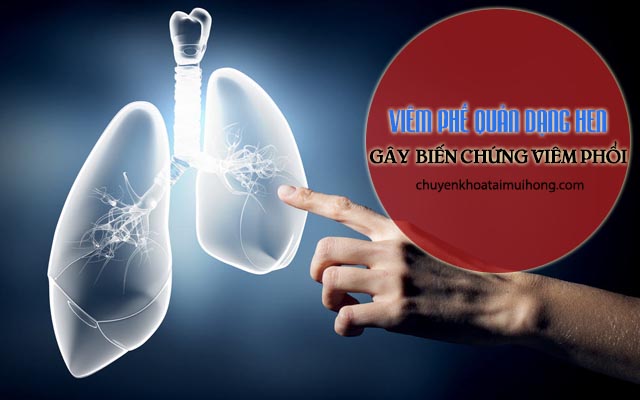 Viêm phổi dạng hen gây biến chứng viêm phổi