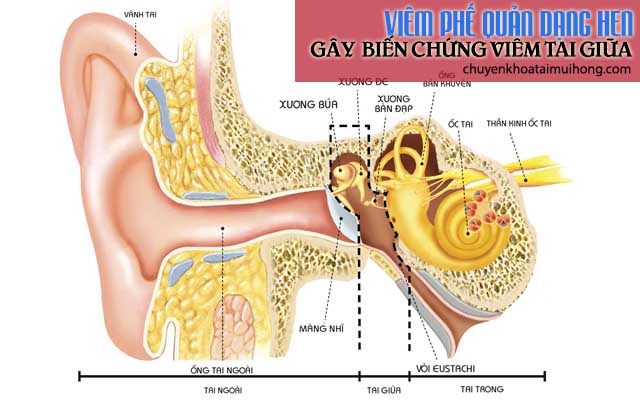 Viêm phế quản dạng hen gây biến chứng viêm tai giữa