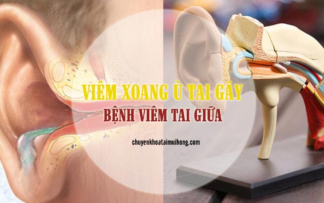 Viêm xoang ù tai gây bệnh viêm tai giữa