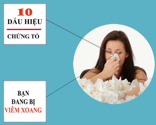 Dấu hiệu viêm xoang