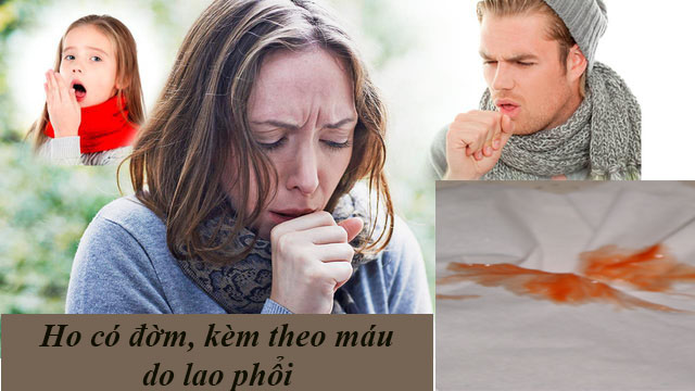 Ho có đờm, kèm theo máu do lao phổi