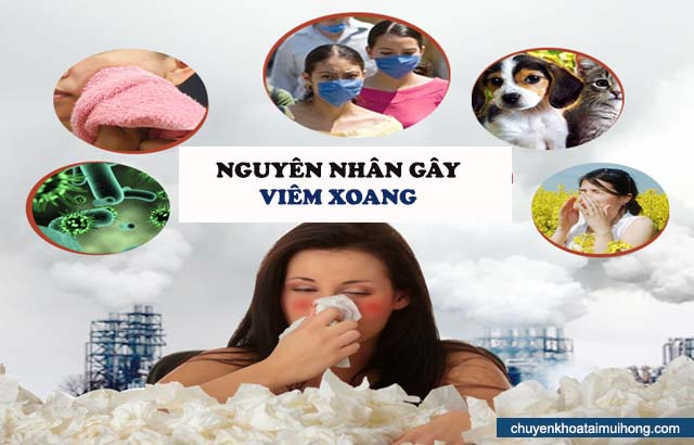 nguyên nhân gây ra bệnh viêm xoang