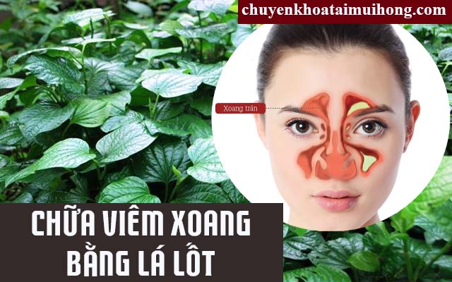 Cách trị viêm xoang bằng lá lốt Trị viêm xoang bằng lá lốt