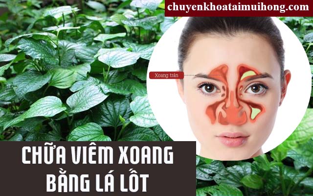 Trị viêm xoang bằng lá lốt