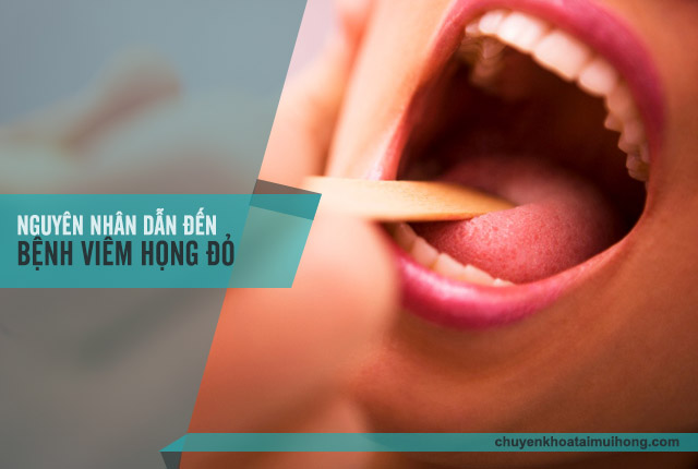 Bệnh viêm họng đỏ