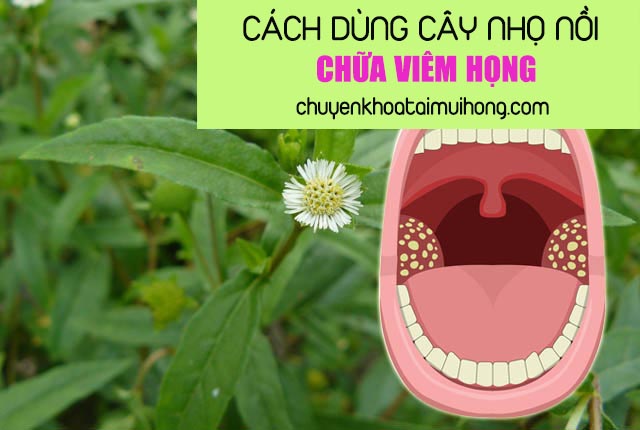 Mách bạn cách dùng cây nhọ nồi chữa viêm họng