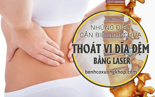 Điều cần biết khi chữa thoát vị đĩa đệm bằng laser