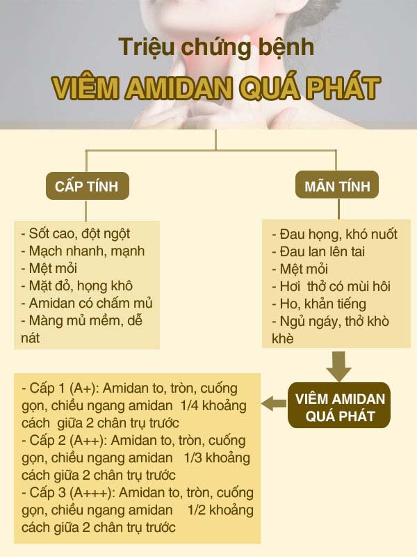 Sơ đồ triệu chứng của viêm amidan quá phát