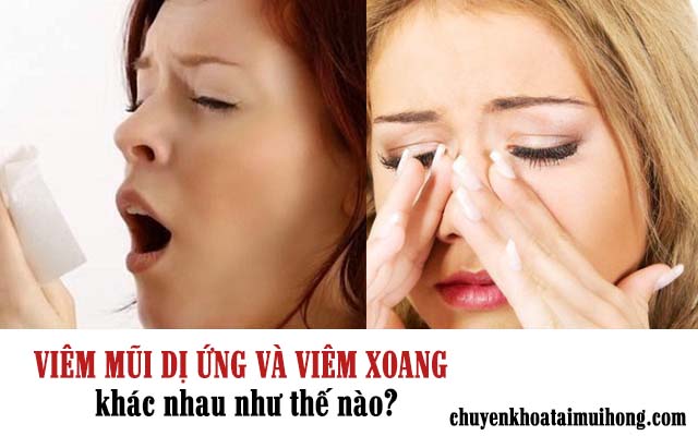 Viêm mũi dị ứng và viêm xoang khác nhau như thế nào?