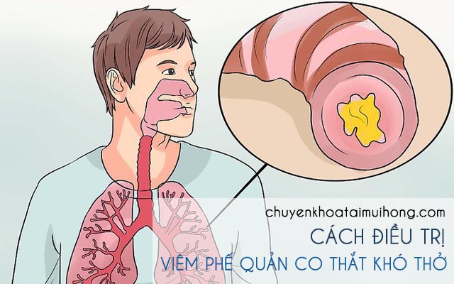 Cách chữa bệnh viêm phế quản co thắt khó thở