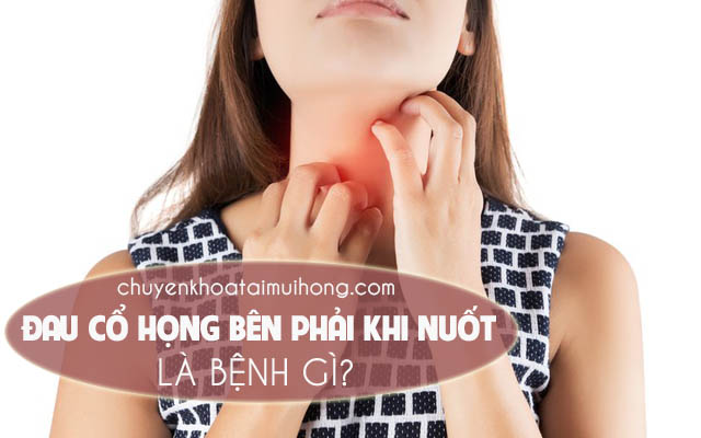 Đau cổ họng bên phải khi nuốt là bệnh gì? 