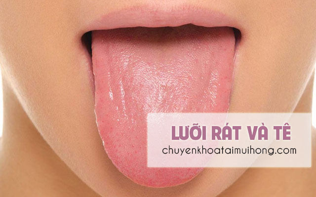 Lưỡi rát và tê là bị bệnh gì? Làm gì để khắc phục?