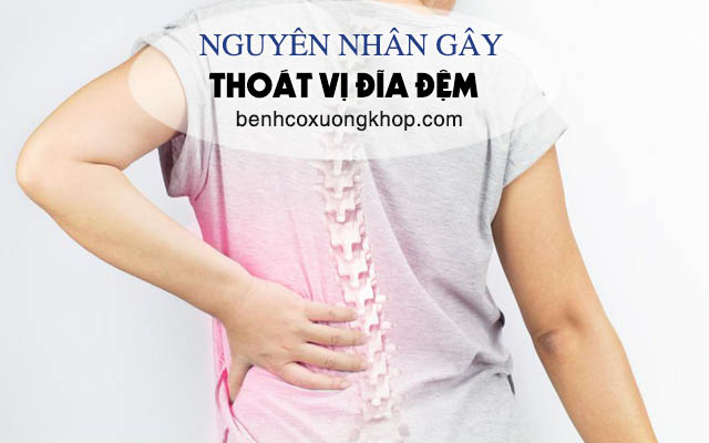 Nguyên nhân gây thoát vị đĩa đệm