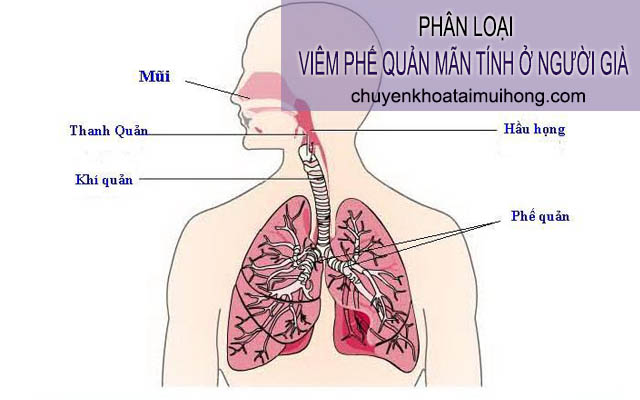 Phân loại viêm phế quản mãn tính ở người già