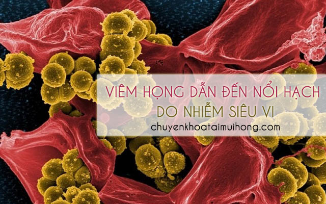 Viêm họng gây nổi hạch do cơ thể người bệnh bị nhiễm siêu vi 