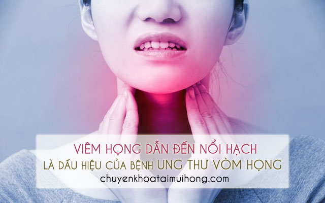 Viêm họng nổi hạch là dấu hiệu của bệnh ung thư vòm họng