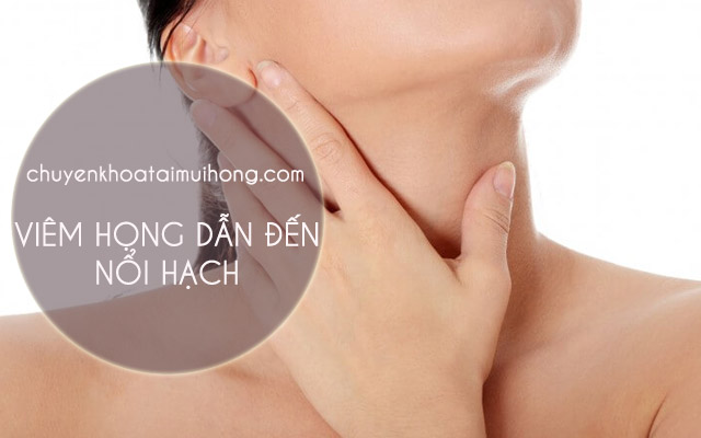 Làm gì khi viêm họng dẫn đến nổi hạch?