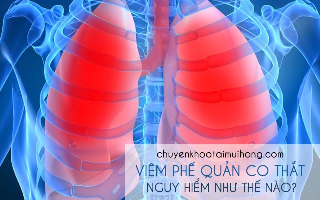 Bệnh viêm phế quản co thắt nguy hiểm như thế nào?