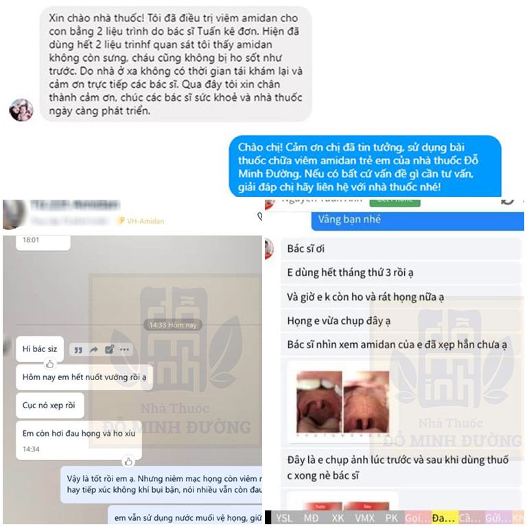Feedback của bệnh nhân chữa viêm amidan tại Đỗ Minh Đường