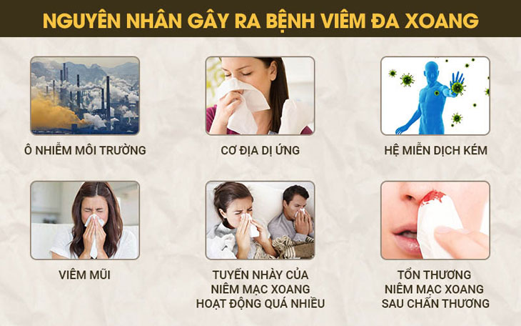 Có nhiều nguyên nhân gây viêm đa xoang