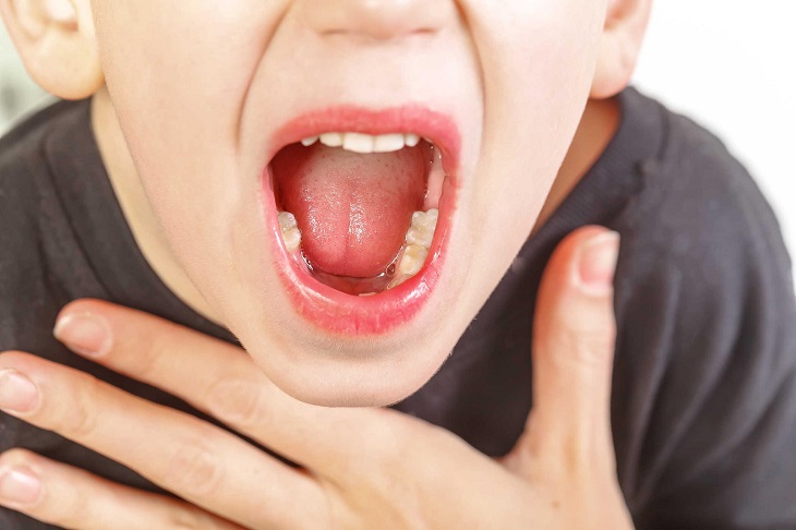 Người bệnh viêm họng hạt rất khổ sở bởi triệu chứng bệnh gây ra Người bệnh viêm họng hạt rất khổ sở bởi triệu chứng bệnh gây ra