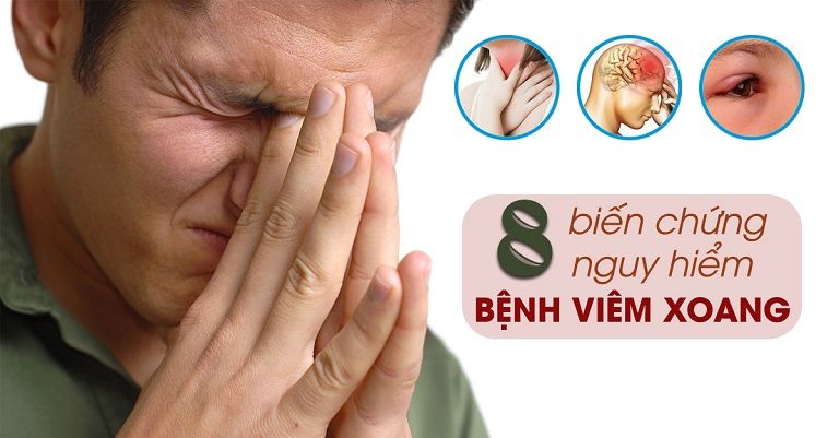 Những biến chứng nguy hiểm của viêm xoang 