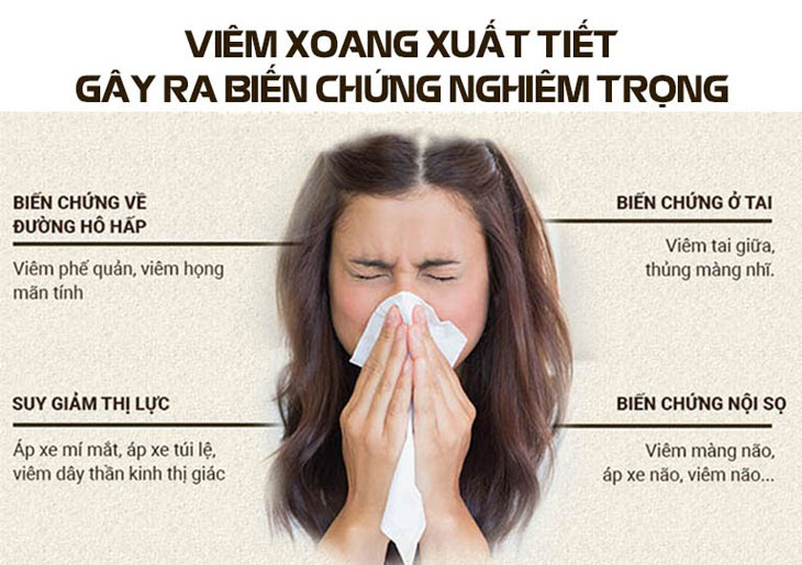 Những biến chứng nguy hại của viêm mũi xoang xuất tiết Những biến chứng nguy hại của viêm mũi xoang xuất tiết