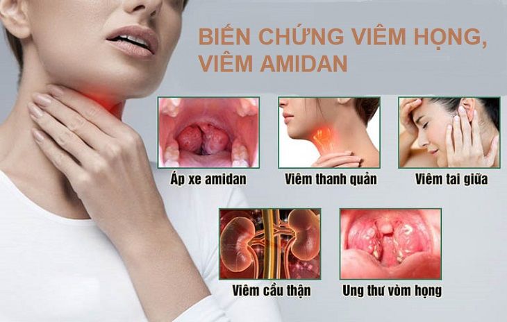 Biến chứng bệnh viêm họng, viêm amidan 