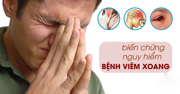 Xoang bị tổn thương lâu ngày dễ gây biến chứng nguy hiểm Xoang bị tổn thương lâu ngày dễ gây biến chứng nguy hiểm
